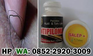 Bukti Barang Sampai Real Asli Obat Kutil Kelamin