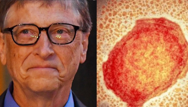 ¿Bill Gates advirtió la viruela del mono hace cinco meses? Estas fueron sus duras palabas