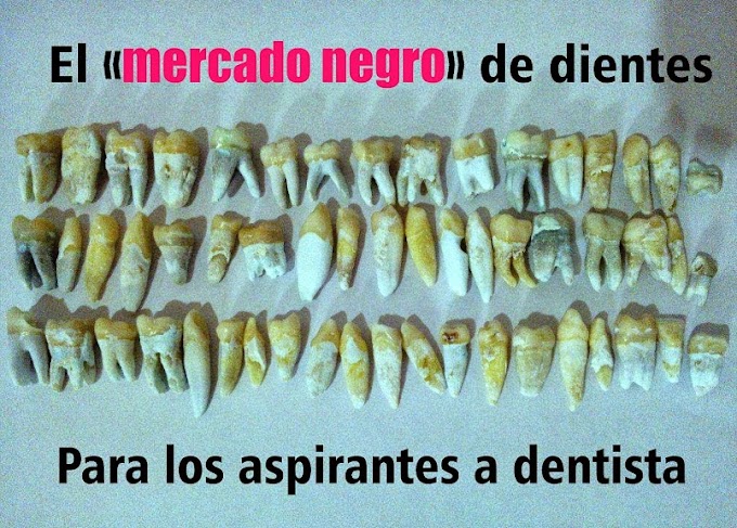 NOTIDENTAL: El «Mercado Negro» de dientes para los aspirantes a Dentista