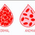 Anemia 