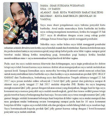 Obat Pengahancur Kista Endometriosis Tradisional