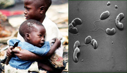 Definisi Penyakit Kolera