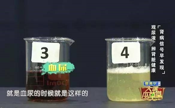 clip_image011