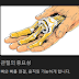 혹시 나도 관절염? 초기 증상 10가지와 자가 진단법, 통증 완화 방법 정리