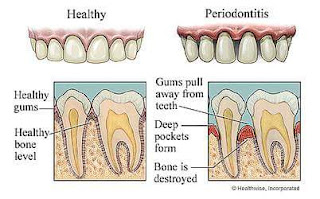 Private Dental Institutes in Kerala