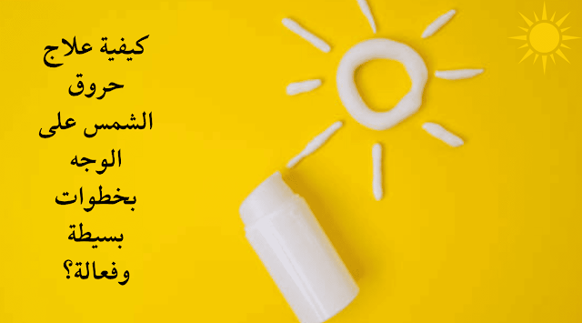 علاج حروق الشمس