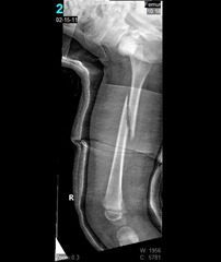 broken femer healing 2-15-2011 (2)