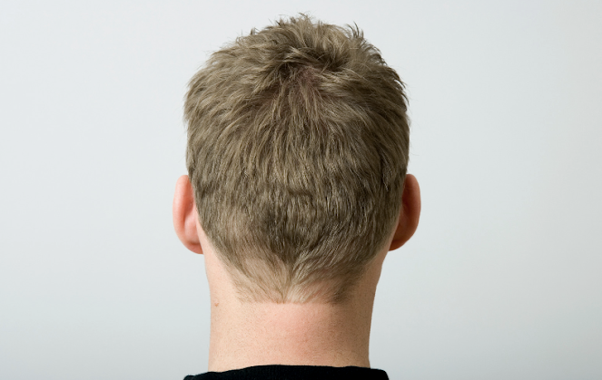 highly effective hair loss treatment plan for men