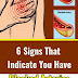6 Signs That Indicate You Have Blocked Arteries