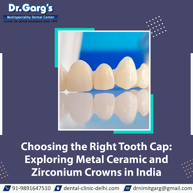 Zirconium Crowns in India