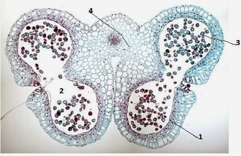 Diagrama y fotografía del corte transversal de una antera. Arriba a la izquierda la antera inmadura, y abajo la antera madura. Los microsporangios contienen los microsporocitos que son células diploides. Cada uno realiza la meiosis para producir una cuarteta o cuarteta de microsporas haploides.