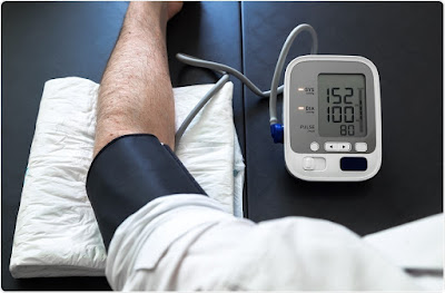 Blood pressure monitor