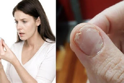 What You Should Do About Hair Loss and Brittle Nails Treatment