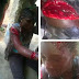 Barbaric! See what a woman allegedly did to her husband's girlfriend in Cross River (graphic photos)