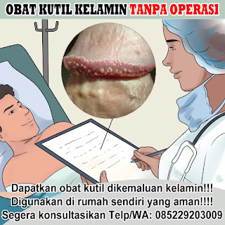 Obat Kutil Kelamin