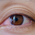 Prevalence of Diabetes eye problem has increased alarmingly