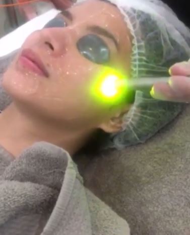 Angel Locsin Looked Stunning During Her Bright White Laser Treatment At The Aivee Clinic! 
