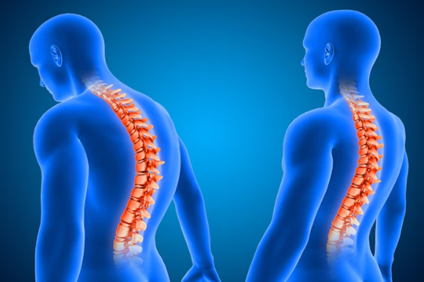 Back And Spine Pain