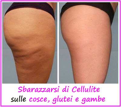 Libera-Dalla-Cellulite-metodi-naturali-Symulast-per-eliminare-la-cellulite