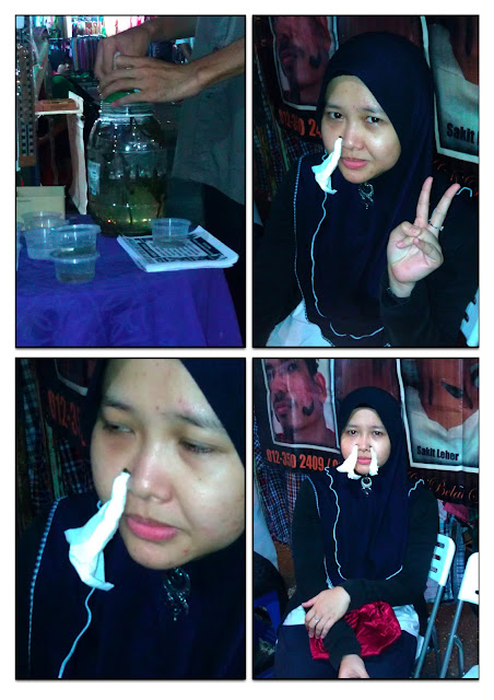 EILa :: ~: Terapi Bekam Lintah EILa :: ~: Terapi Bekam Lintah