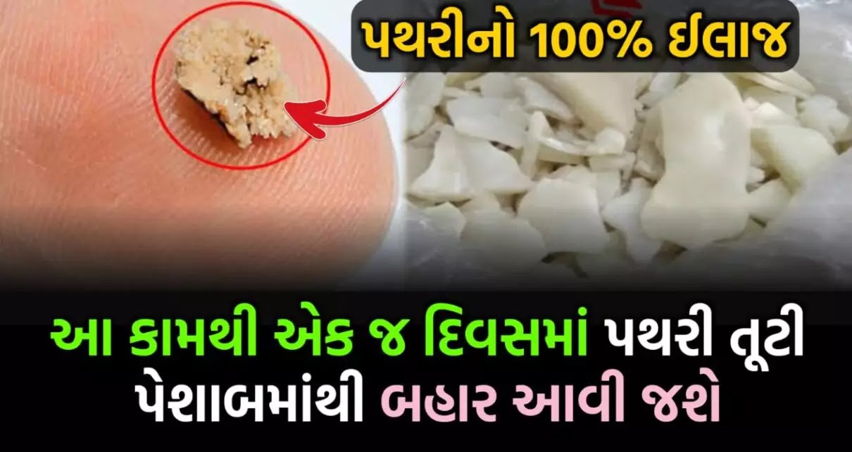 એક દિવસમાં મોટી પથરી પણ તૂટીને પેશાબ વાટે નીકળી જશે બહાર, જાણો પથરી દૂર કરતા ઉપાય.