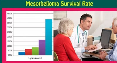 Survival Rate After Diagnosis of Mesothelioma - Does Anyone Survive Mesothelioma