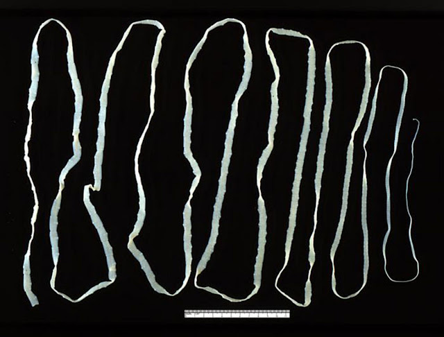 Широкий лентец (Diphyllobothrium latum)