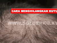 Cara Menghilangkan Kutu Rambut Dengan Mudah