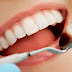 Bọc răng sứ thẫm mỹ chất lượng cao ở đâu?