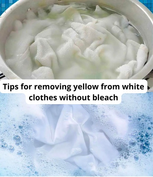 Tips for removing yellow from white clothes without bleach