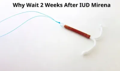 Why Wait 2 Weeks After IUD Mirena