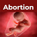 What is Abortion?