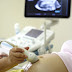 Hamile kadının kürtaj talebi:Bebeğin burcunu beğenmedi