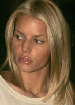 Jessica Simpson lips plastic surgery