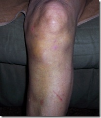 more knee 8.10 001