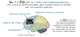 schéma cerveau  TDAH trouble neuro développemental 