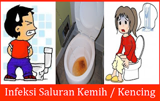 http://de-natur-indonesia.blogspot.com/2017/05/nyeri-di-penis-dan-kencing-setiap-1-jam.html