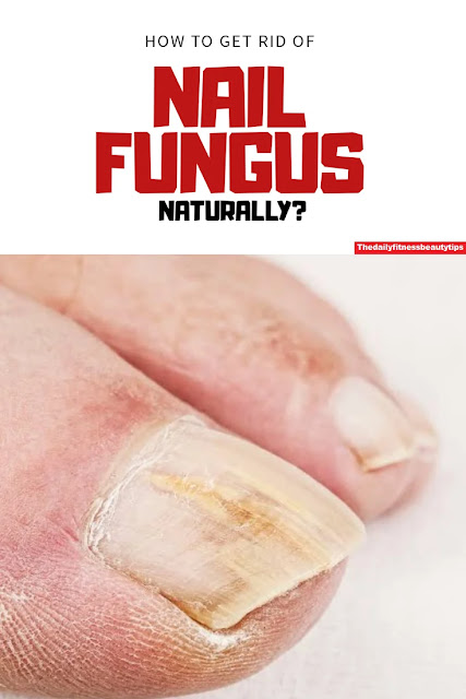 Nail-fungus-treatment