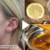 How Remove Acne-Pimples Overnight With Lemon And Turmeric Paste