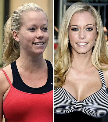 Hollywood Celebrities With & Without Makeup