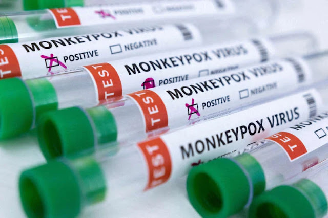 Ogun confirms four cases of monkeypox