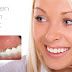 Niềng răng mặt trong giá bao nhiêu khi điều trị móm ?