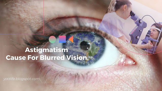 Astigmatism - Cause For Blurred Vision