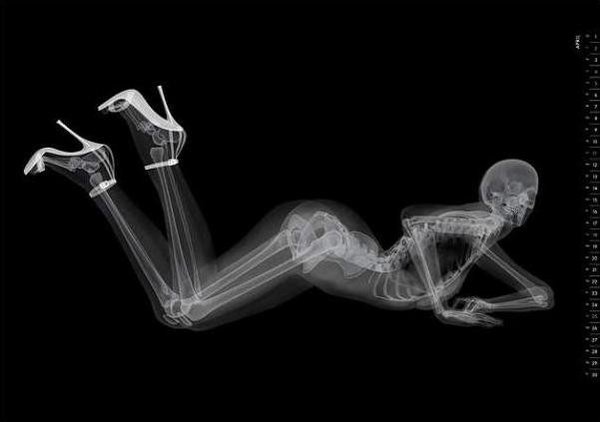 This year's most provocative pin-up calendar features X-rayed not X-rated 