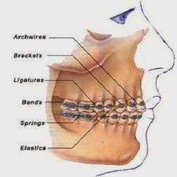 www.bestdentistbangalore.com/orthodontics/