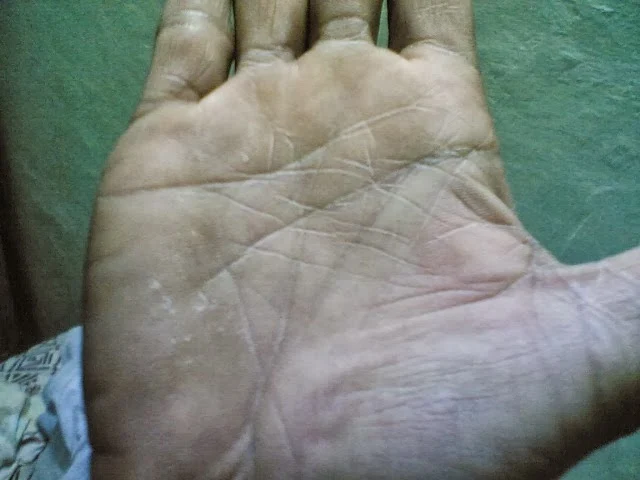 Rahu Lines Palmistry