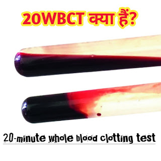 20-minute whole blood clotting test, 20WBCT, clotting time,