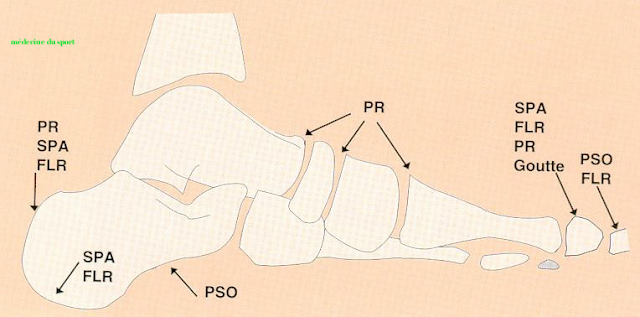 Examen clinique du pied et de la cheville