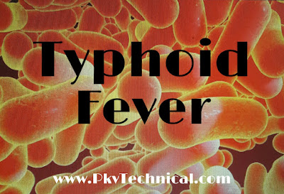 Typhoid Fever