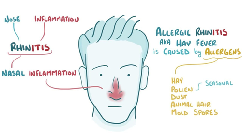 Symptoms of Allergies to